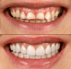 aesthetic-smile-design-treatment-dental-600nw-2486400333