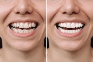 cropped-shot-young-caucasian-smiling-600nw-2328458421