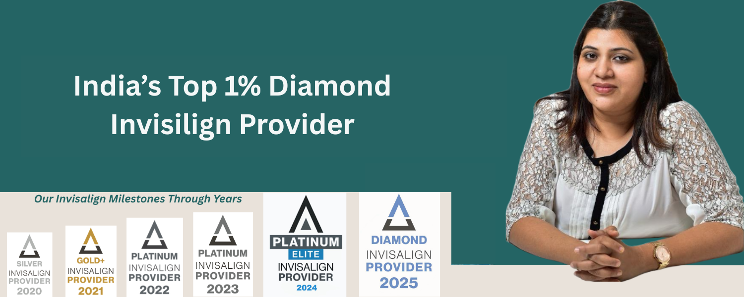 Diamond Invisilign