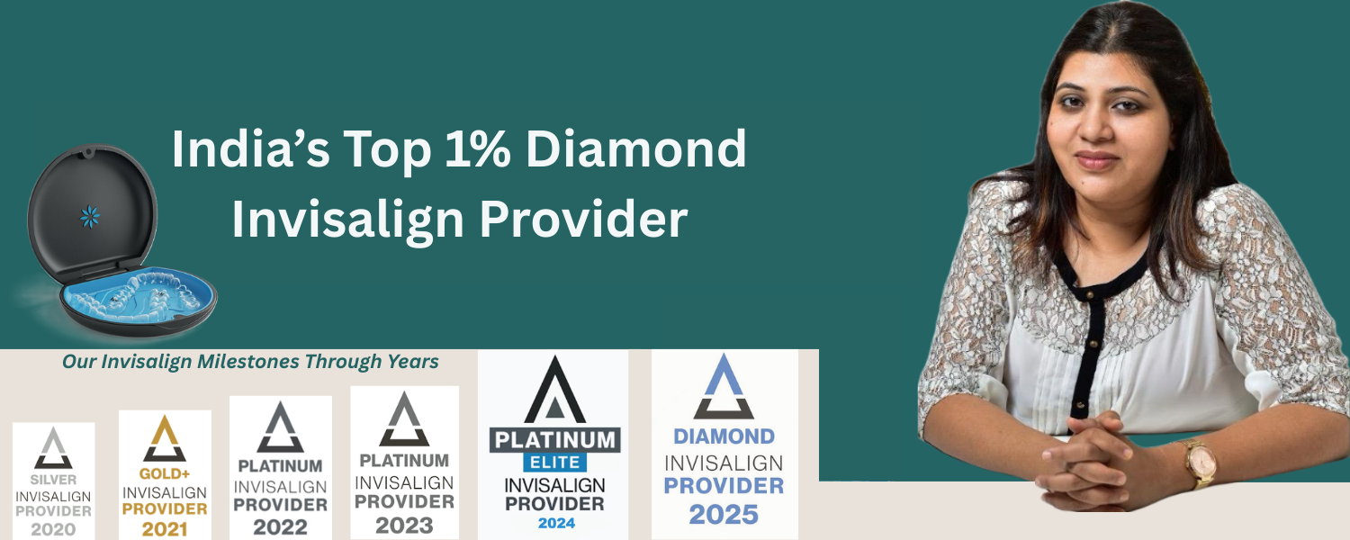 diamond invisalign (1)